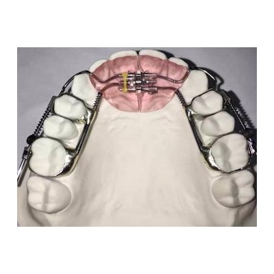 3D打印隐形正畸矫正器深圳义齿厂家-牙齿隐形矫正隐形矫治器