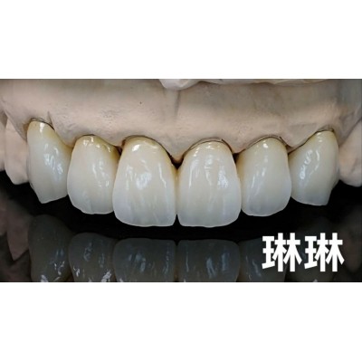 香港假牙种植牙义齿加工厂家