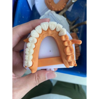 德国假牙种植牙义齿加工