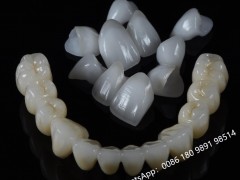 美国牙诊所把牙模拿到中国义齿工厂生产有什么好处？